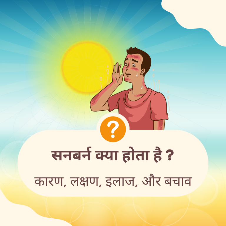 सनबर्न (Sunburn) क्या है?